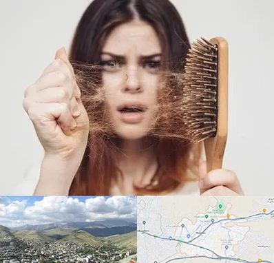 دکتر ریزش مو در رودهن