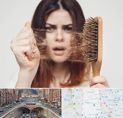 دکتر ریزش مو در منطقه 10 تهران 