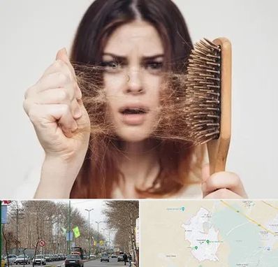 دکتر ریزش مو در نظرآباد کرج