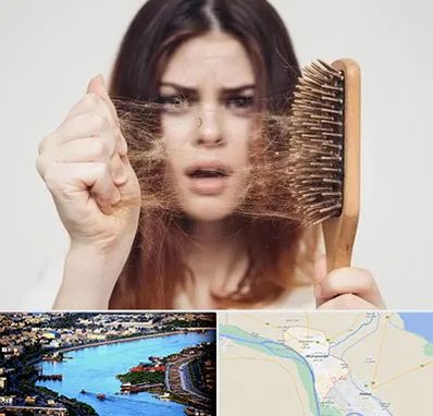 دکتر ریزش مو در خرمشهر