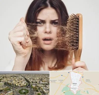 دکتر ریزش مو در قزوین