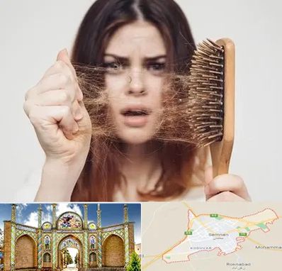 دکتر ریزش مو در سمنان