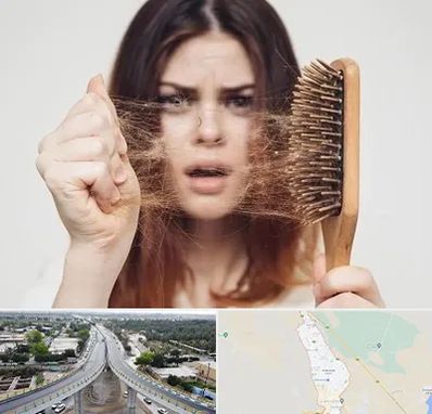 دکتر ریزش مو در اندیمشک