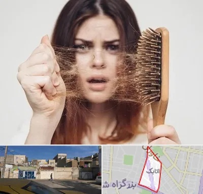 دکتر ریزش مو در اتابک