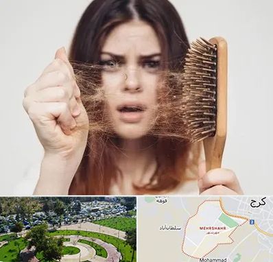 دکتر ریزش مو در مهرشهر کرج 