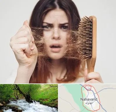 دکتر ریزش مو در نهاوند
