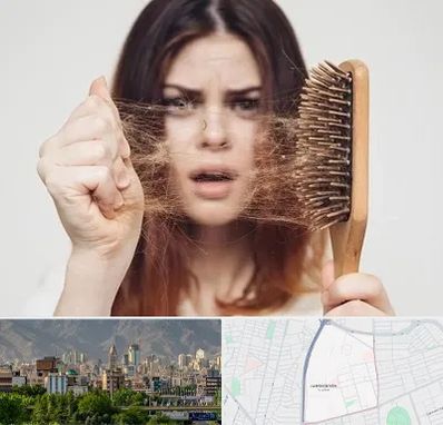 دکتر ریزش مو در جمشیدیه