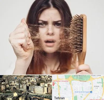 دکتر ریزش مو در مرزداران 