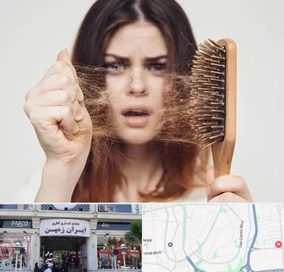 دکتر ریزش مو در ایران زمین