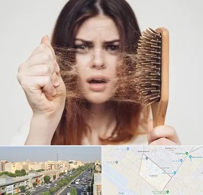 دکتر ریزش مو در کیانمهر کرج
