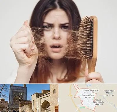 دکتر ریزش مو در تربت جام