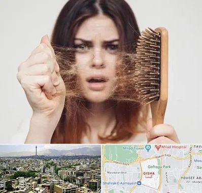 دکتر ریزش مو در گیشا 