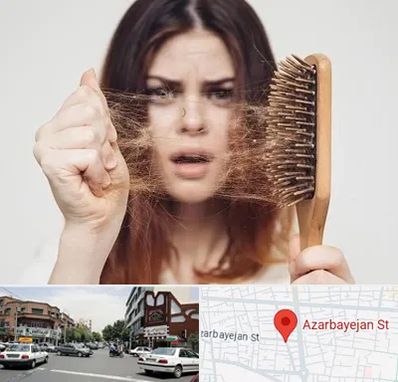 دکتر ریزش مو در خیابان آذربایجان