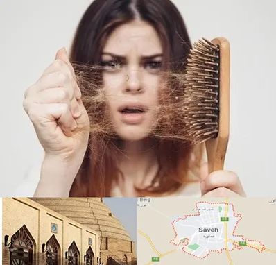 دکتر ریزش مو در ساوه