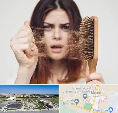 دکتر ریزش مو در ملارد