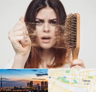 دکتر ریزش مو در غرب تهران 