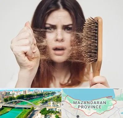 دکتر ریزش مو در مازندران