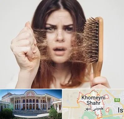 دکتر ریزش مو در خمینی شهر