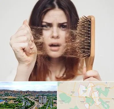 دکتر ریزش مو در شهریار