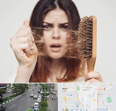 دکتر ریزش مو در ستارخان 