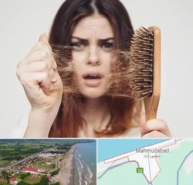 دکتر ریزش مو در محمودآباد