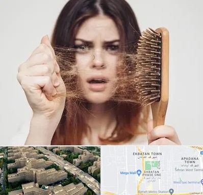 دکتر ریزش مو در اکباتان 