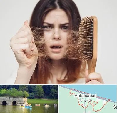دکتر ریزش مو در عباس آباد