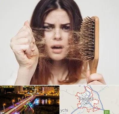 دکتر ریزش مو در سقز