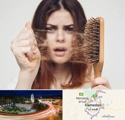 دکتر ریزش مو در همدان