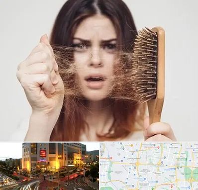 دکتر ریزش مو در جنت آباد تهران 