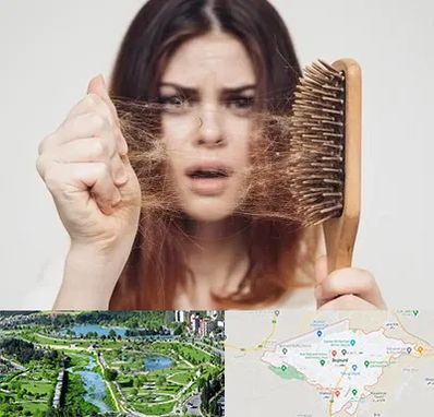 دکتر ریزش مو در بجنورد