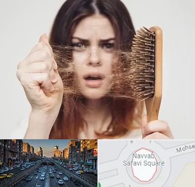 دکتر ریزش مو در نواب