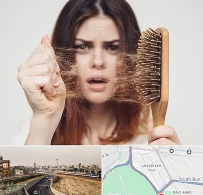 دکتر ریزش مو در جوادیه