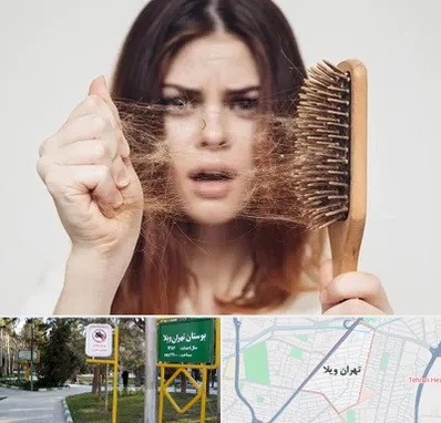 دکتر ریزش مو در تهران ویلا