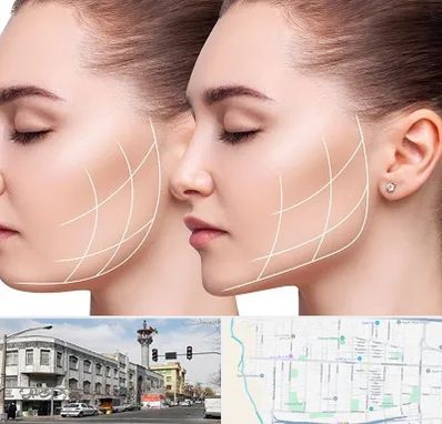 جراحی بوکال فت در 17شهریور