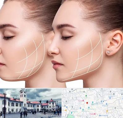 جراحی بوکال فت در میدان شهرداری رشت