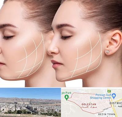 جراحی بوکال فت در شهرک گلستان شیراز