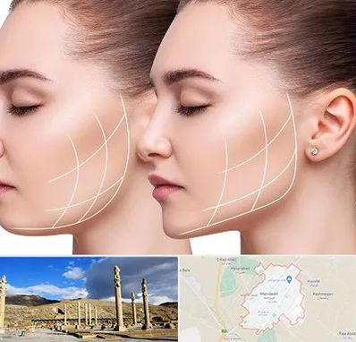 جراحی بوکال فت در مرودشت