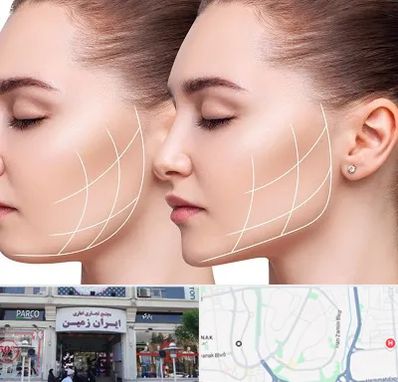 جراحی بوکال فت در ایران زمین