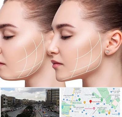 جراحی بوکال فت در بلوار فردوسی مشهد