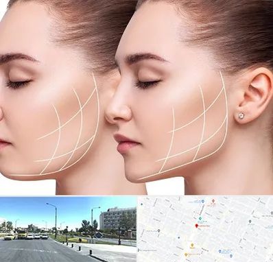 جراحی بوکال فت در بلوار کلاهدوز مشهد