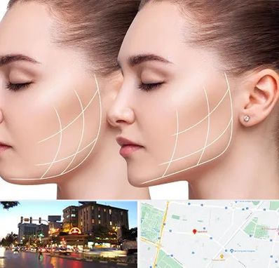 جراحی بوکال فت در بلوار سجاد مشهد