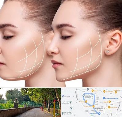 جراحی بوکال فت در بلوار گیلان رشت