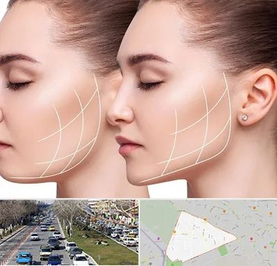 جراحی بوکال فت در احمدآباد مشهد