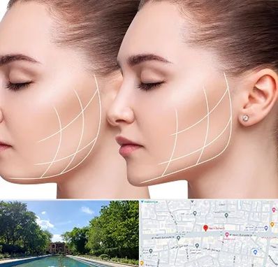 جراحی بوکال فت در هشت بهشت اصفهان