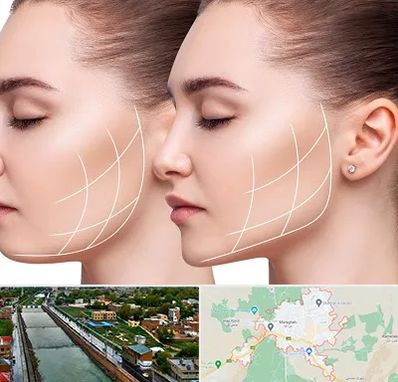 جراحی بوکال فت در مراغه