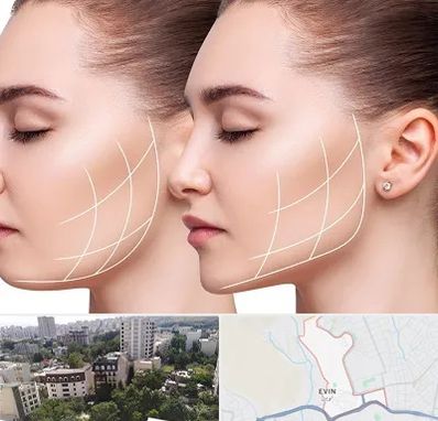 جراحی بوکال فت در اوین