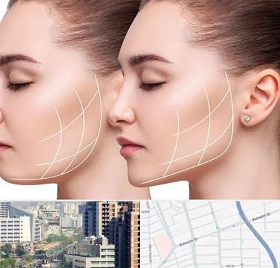 جراحی بوکال فت در خیابان بهشتی