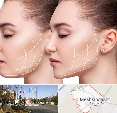 جراحی بوکال فت در مشکین دشت