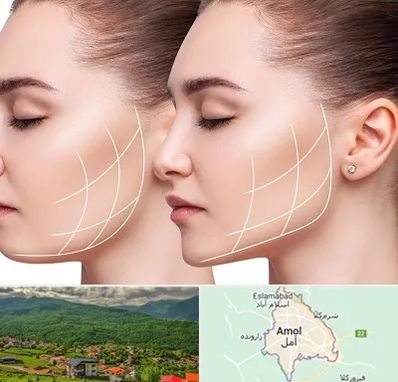 جراحی بوکال فت در آمل